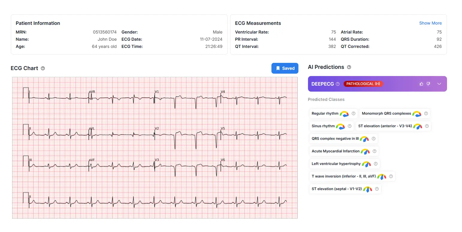 Interactive ECG Analysis